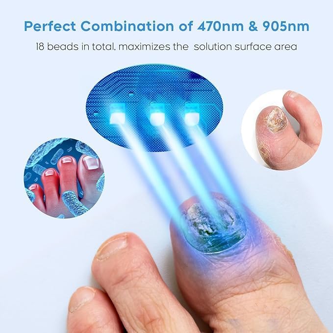 ✨ Home Laser Toenail & Fingernail Fungus Device — Drug-Free Renewal for Your Nails ✨