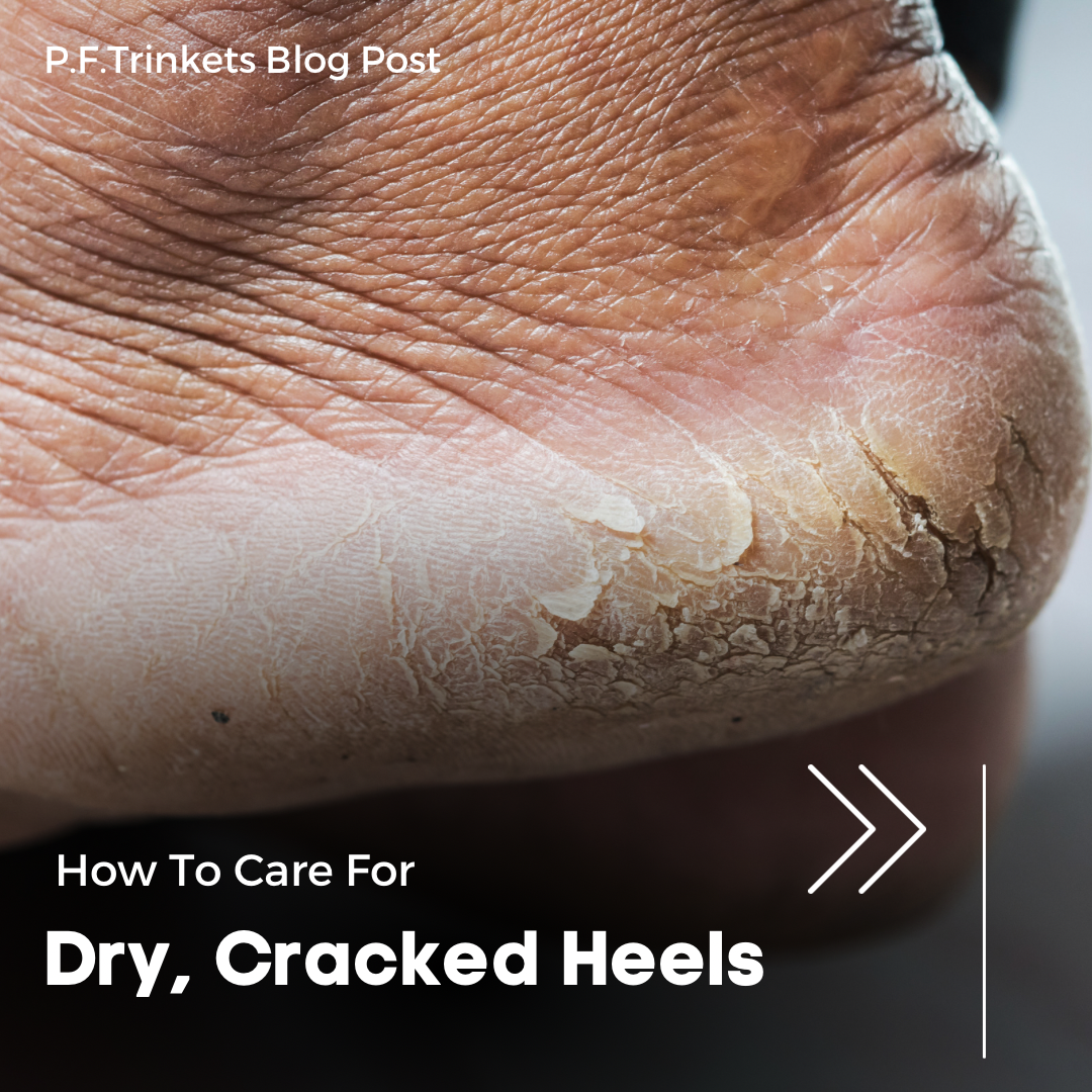 How to Care for Dry, Cracked Heels: 6 Steps to Silky Smooth Feet