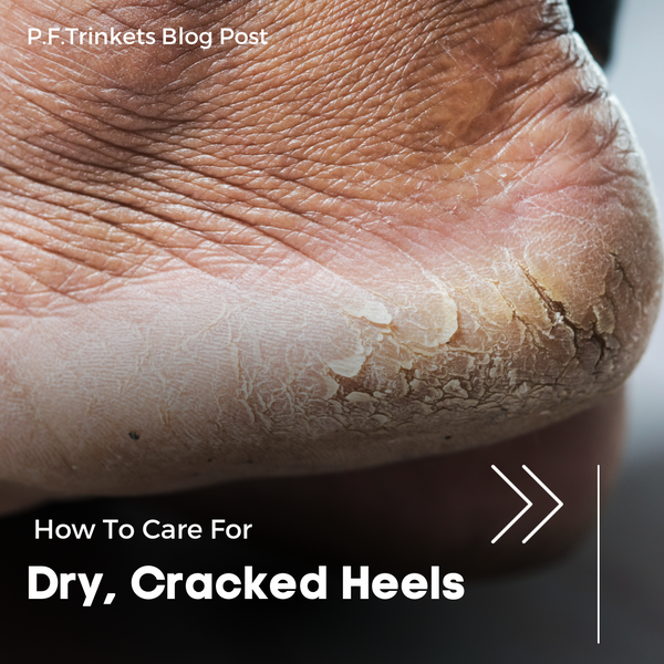 How to Care for Dry, Cracked Heels: 6 Steps to Silky Smooth Feet
