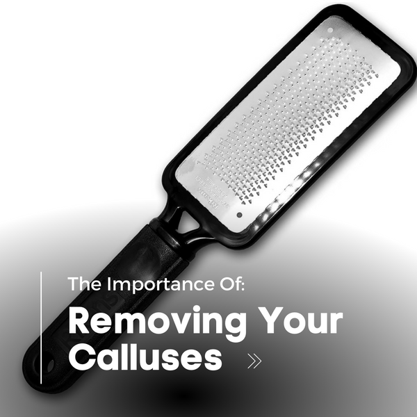 The Importance of Removing Your Calluses
